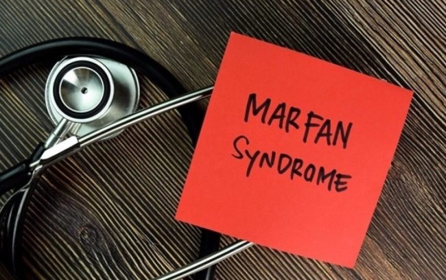 Marfan Syndrome